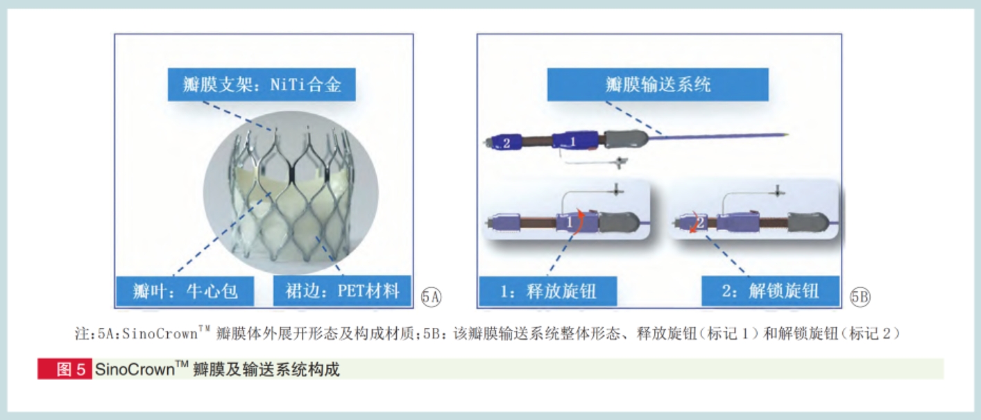 文献速递：中国首例 SinoCrown™经皮介入主动脉瓣置入术